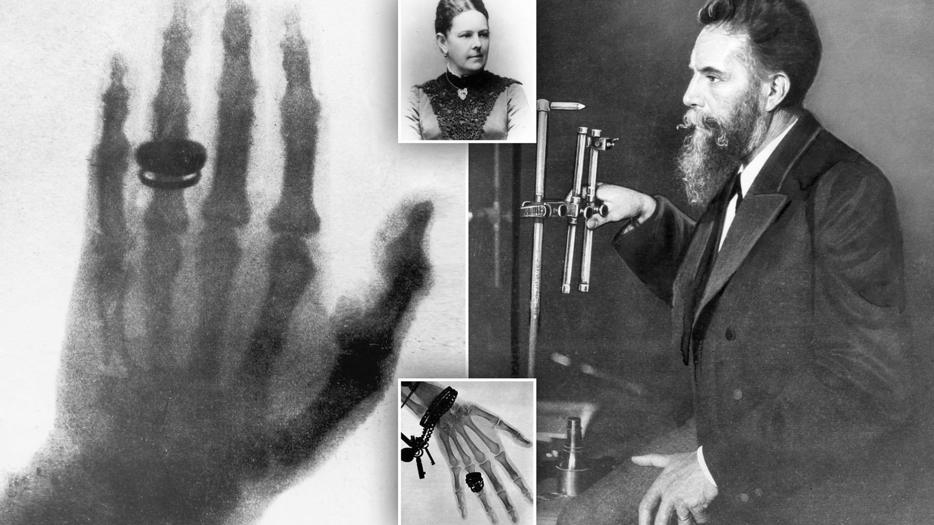 Wilhelm Conrad Röntgen: Penemu Sinar-X